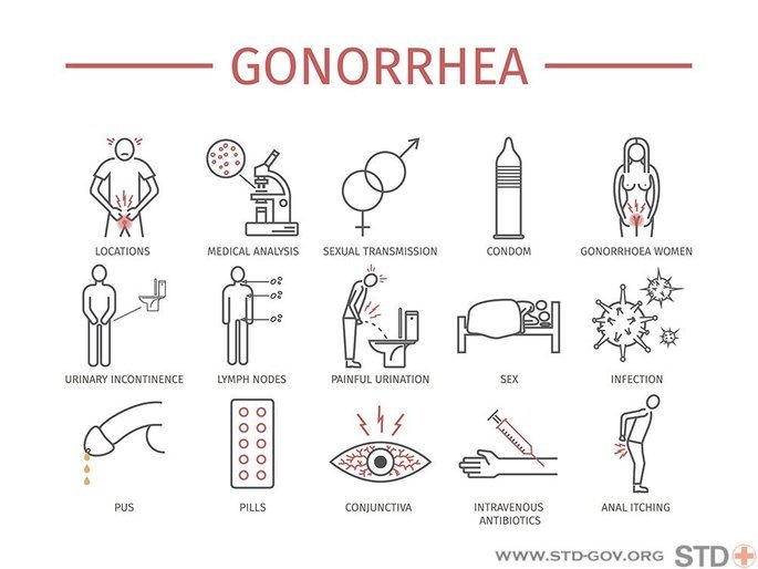 gonorrhea 2