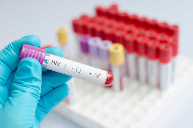 keputusan test hiv 177