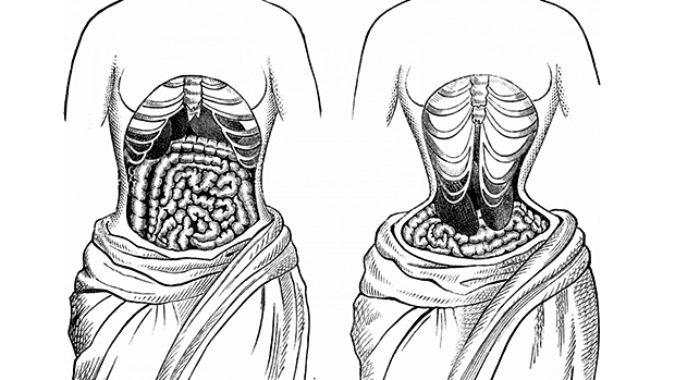 kesan organ dalaman akibat pemakaian korset
