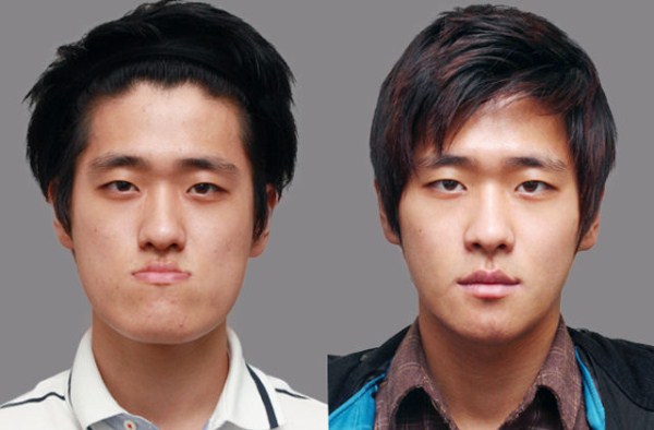 pembedahan plastik korea selatan lelaki