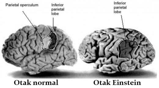 perbezaan otak manusia biasa dan otak albert einstein
