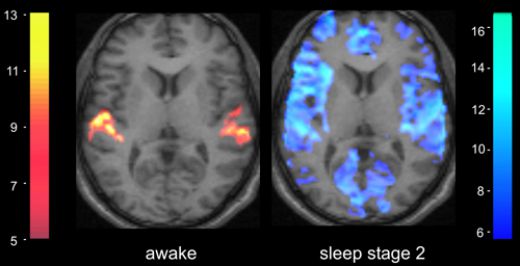 sleep brain