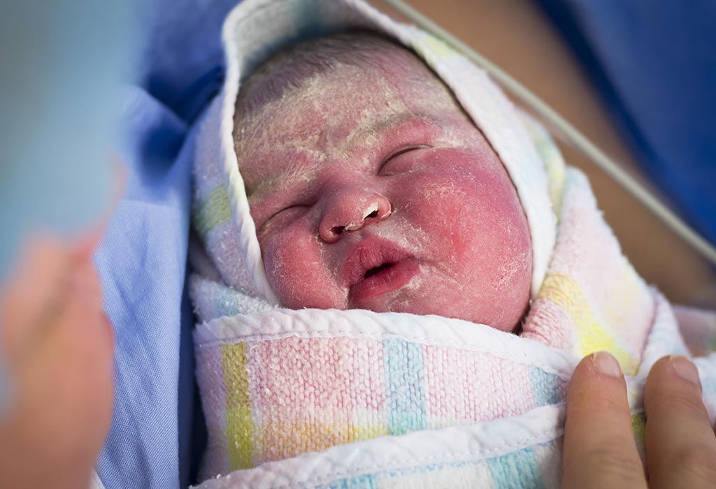 vernix caseosa cecair putih berkrim yang meliputi badan bayi baru lahir 643