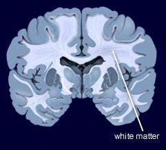 white matter dalam otak