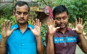 Keunikan Sebuah Keluarga di Bangladesh Yang Tidak Mempunyai Cap Jari
