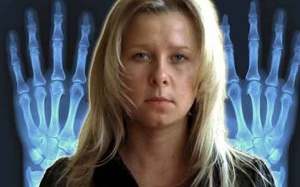 Kisah Gadis Russia Bermata X-Ray Yang Mampu Melihat Organ Manusia