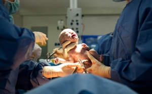 Penerangan Risiko Melahirkan Anak Melalui Pembedahan Caesarean Oleh Doktor Izzat