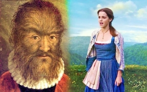Manusia Sebenar Yang Menginspirasikan Kisah Beauty and the Beast - Petrus Gonsalvus