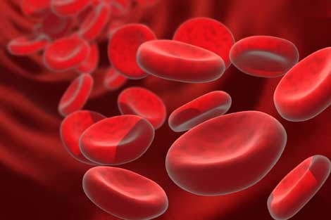 anemia punca orang mudah lesu