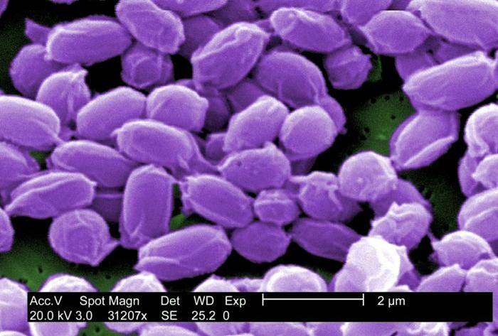 bakteria anthrax