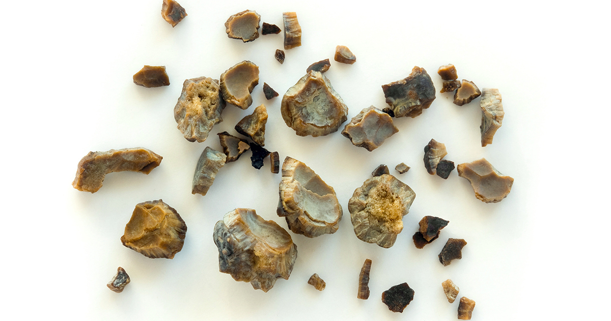 batu karang jenis batu cystine