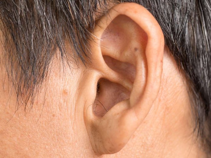 bentuk telinga unik