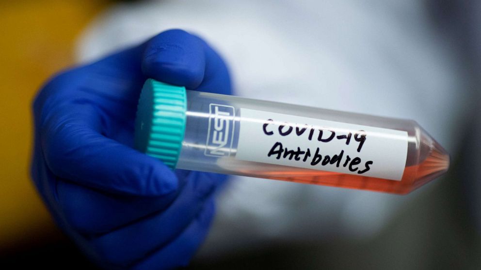 covid 19 antibodi rawatan ujian