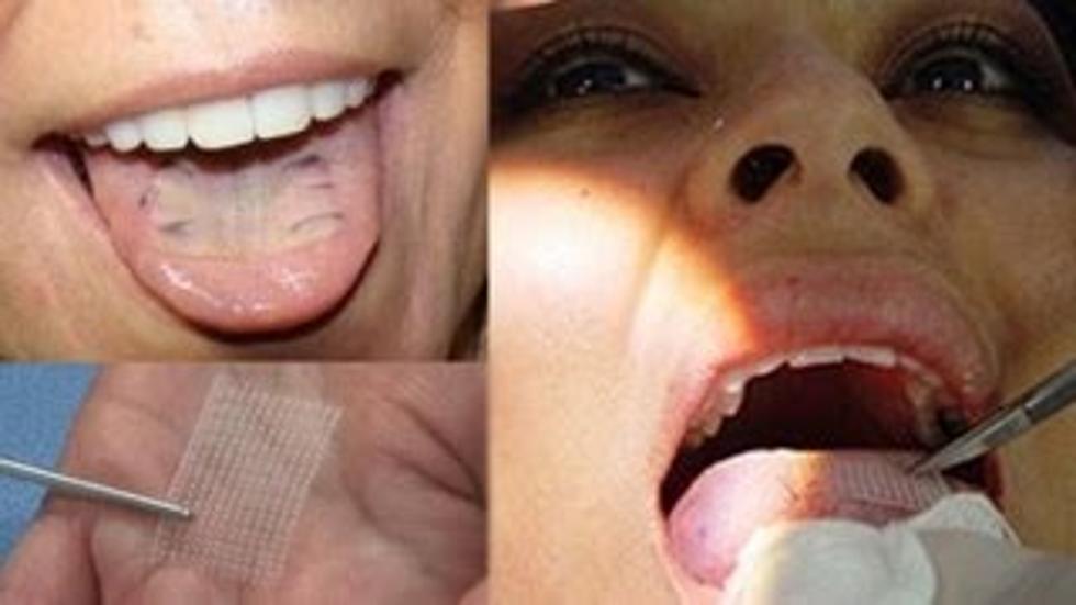 diet tampalan lidah teknik diet menguruskan badan