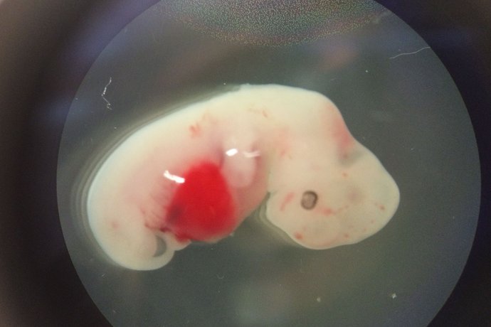 embrio manusia dan khinzir 8 benda pelik berjaya dihasilkan di dalam makmal
