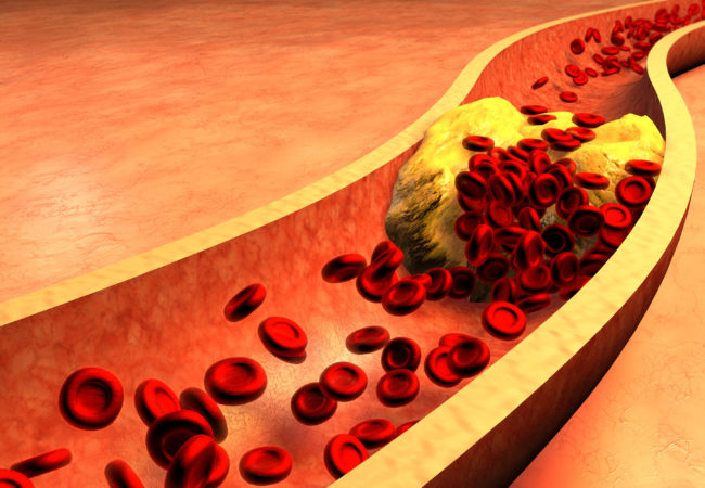 fungsi kolesterol dalam badan
