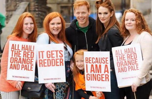 hanya 2 redhead di dunia