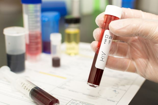 hiv ujian darah