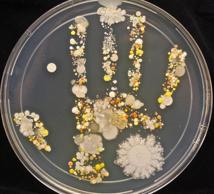 ini gambar betul kuman dan bakteria yang ada pada tapak tangan budak lelaki umur 8 tahun