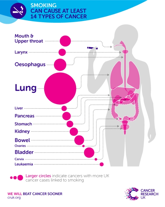 merokok menyebabkan 14 jenis kanser