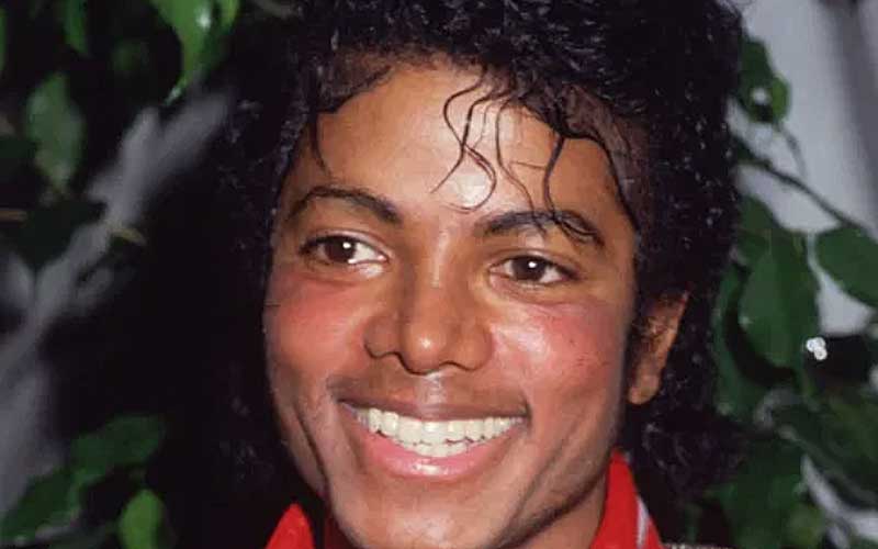 michael jackson vitiligo penyakit kulit 88
