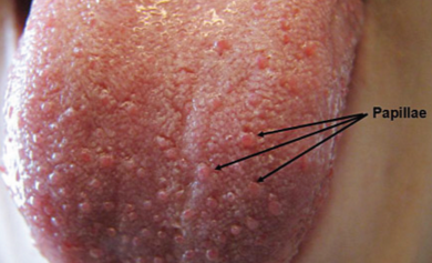 papillae atau biji benjolan pada lidah