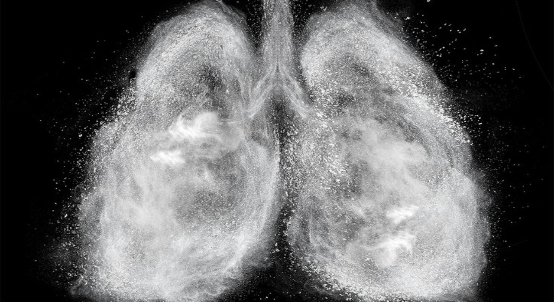 paru paru penghisap vape seperti mangsa serangan gas