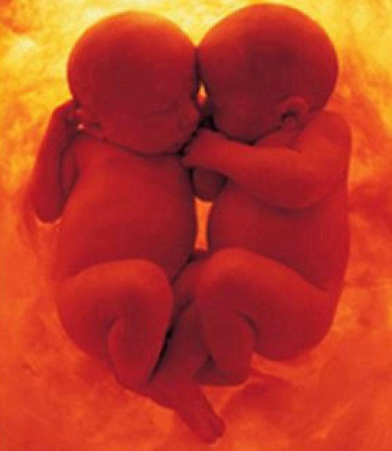 pasangan kembar berinteraksi sejak dari dalam rahim