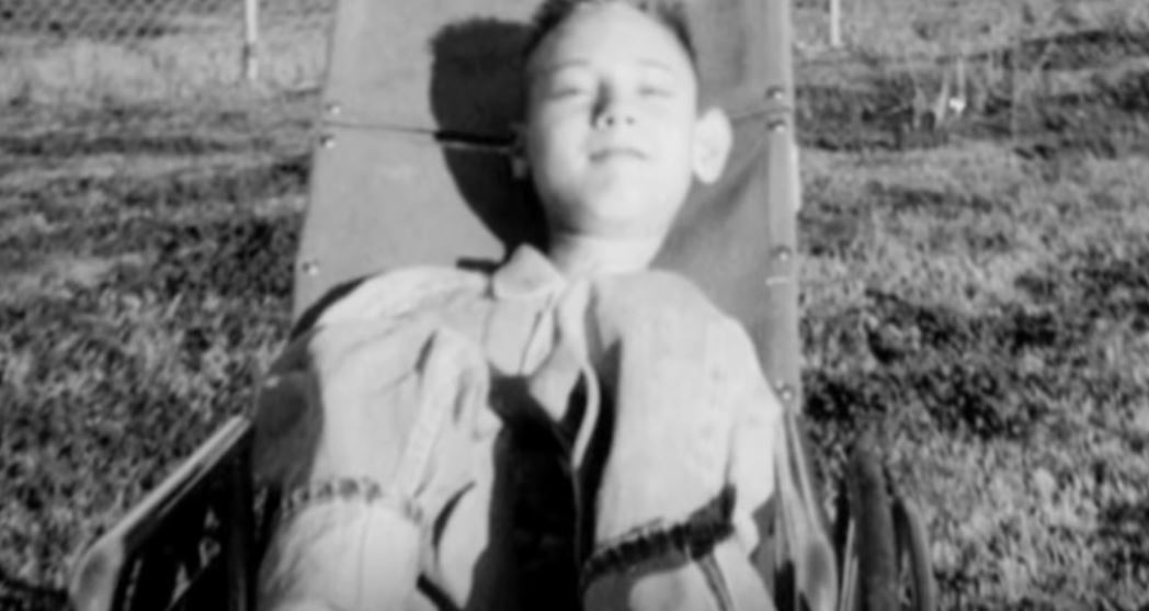 paul alexander pesakit polio ketika berusia 6 tahun