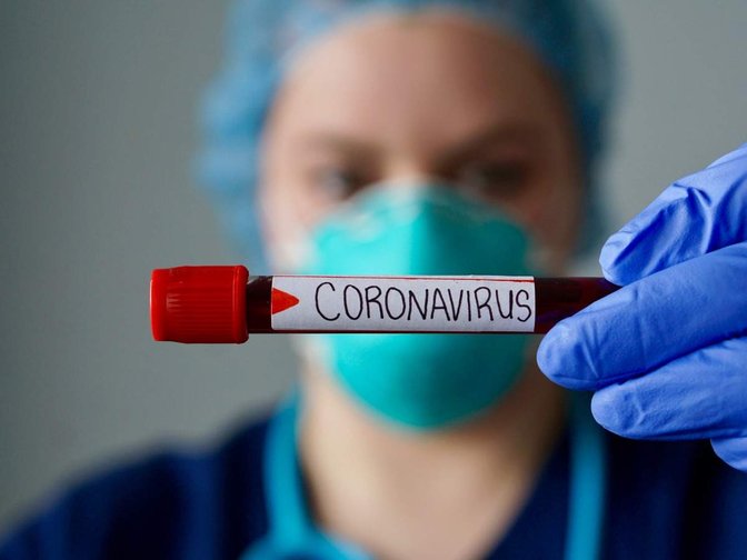 sampel coronavirus covid 19