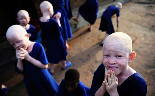 sekolah khas albino