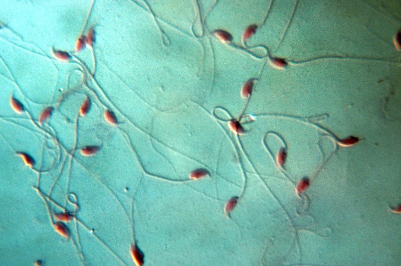 sperma tikus 8 benda pelik berjaya dihasilkan di dalam makmal