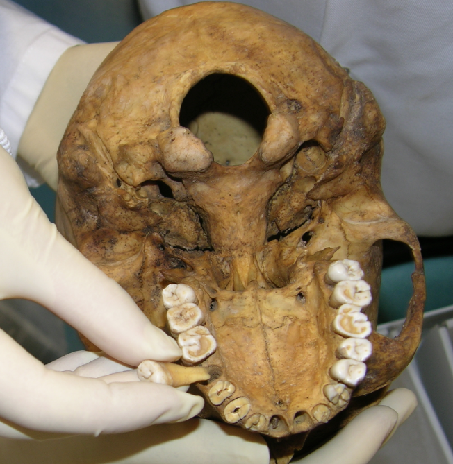 ubat gigi pertama ciptaan mesir purba