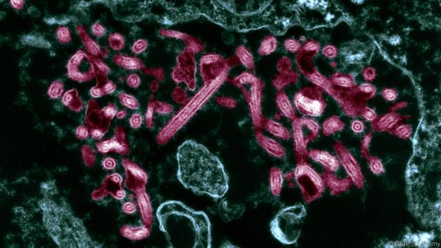 virus ebola 125