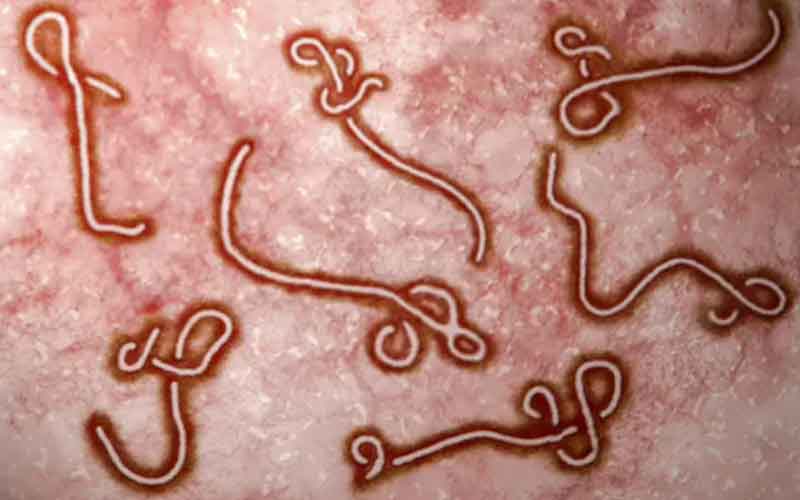virus ebola filovirus