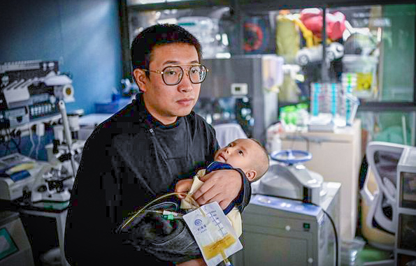xu wei memegang anaknya haoyang yang menghidap sindrom menkes 976