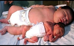 5 Bayi Terbesar Dan Terberat Yang Pernah Dilahirkan Dalam Sejarah