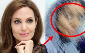 50 Pembedahan Untuk Wajah Seiras Angelina Jolie, Hasilnya Amat Mengejutkan! (7 Gambar)