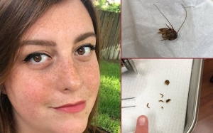 6 kisah ngeri mengenai serangga yang menumpang pada tubuh manusia