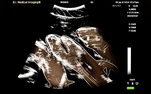 Gambar X-Ray 17 Haiwan Yang Sedang Bunting Atau Mengandung