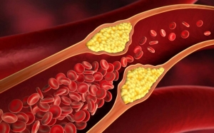 Kesihatan: 5 Fakta Menarik Mengenai Kolesterol
