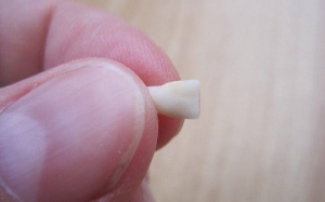 Ketahui Sebab Para Doktor Menyarankan Ibu Bapa Menyimpan Gigi Susu Anak-Anak