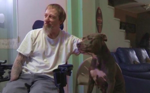 Kisah Lelaki Dipotong Kaki Dan Tangan Kerana Penyakit Bawaan Anjing