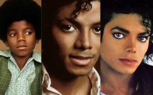 Vitiligo - Punca Kulit Mendiang Michael Jackson Bertukar Warna